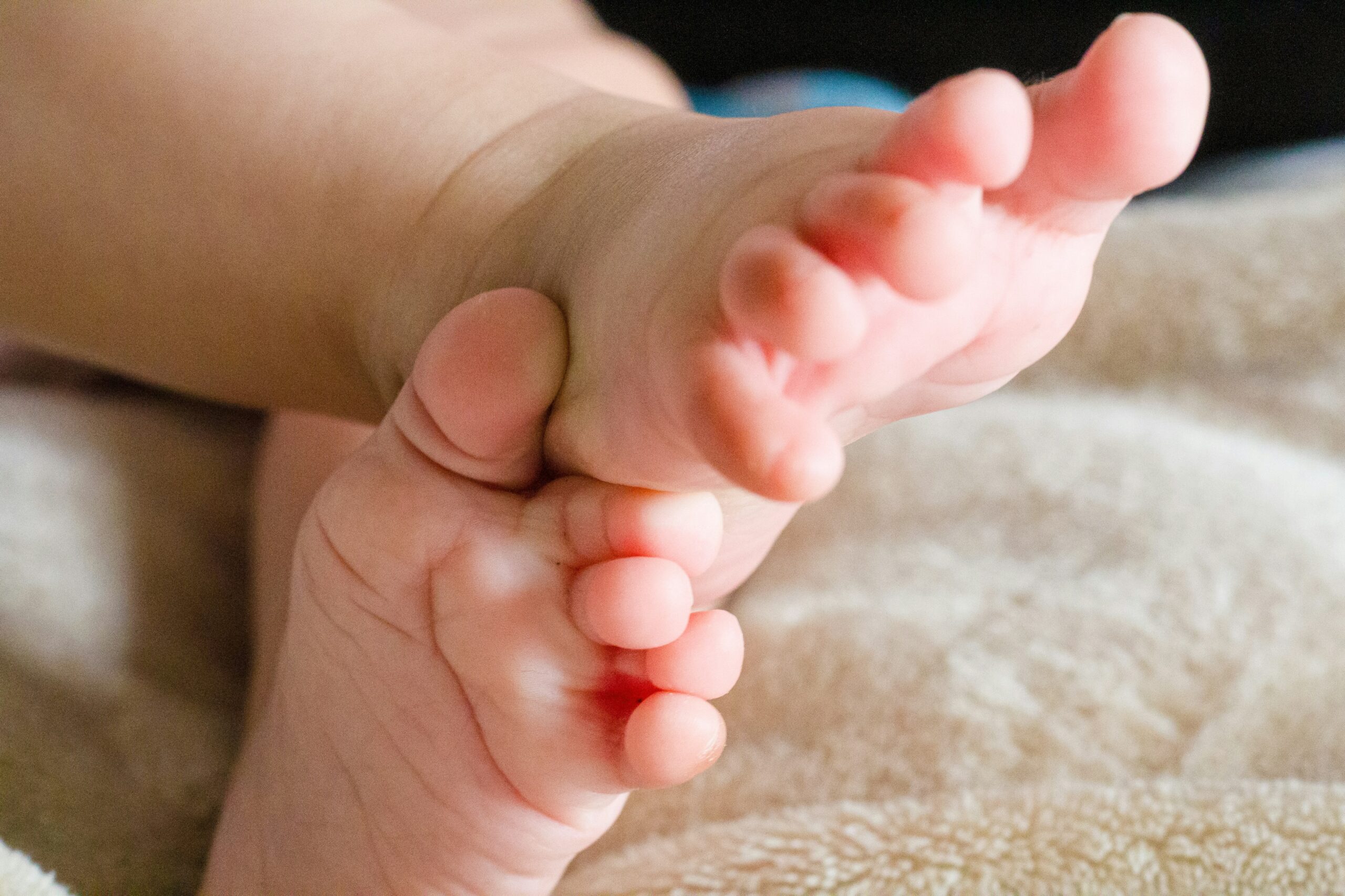 Child Birth Cerebral Palsy Medical Claim